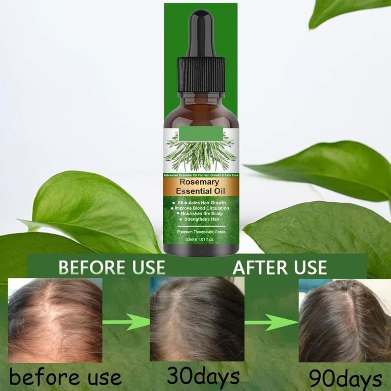 Rosemary Hair Care Essential Oil in UAE – The Secret to Natural Hair Growth & Stronger Roots